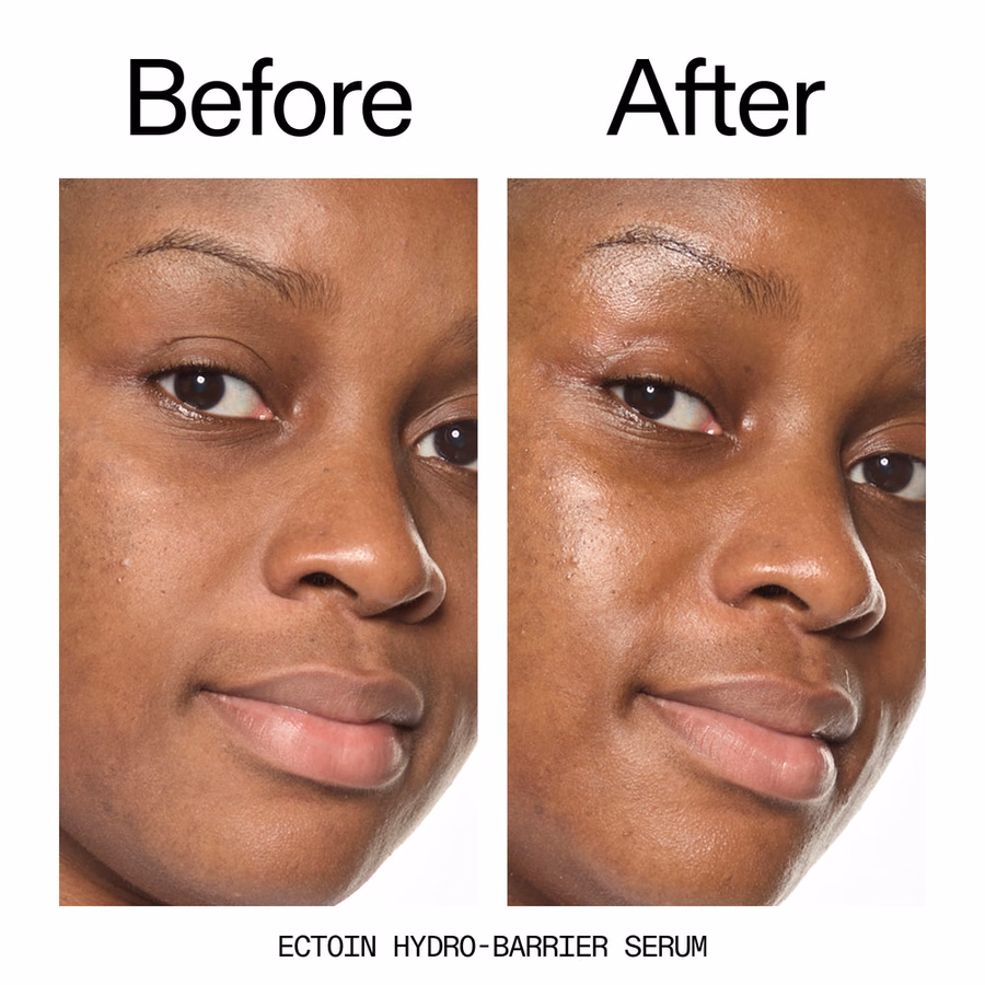 Skin Barrier Protect & Support Kit | Barrier Boosting Trio | INKEY
