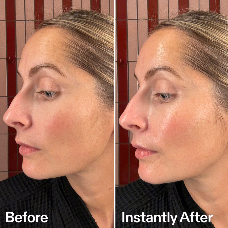 PDRN Serum | 20,000 PPM Vegan PDRN for Glass Skin | $18 | INKEY USA
