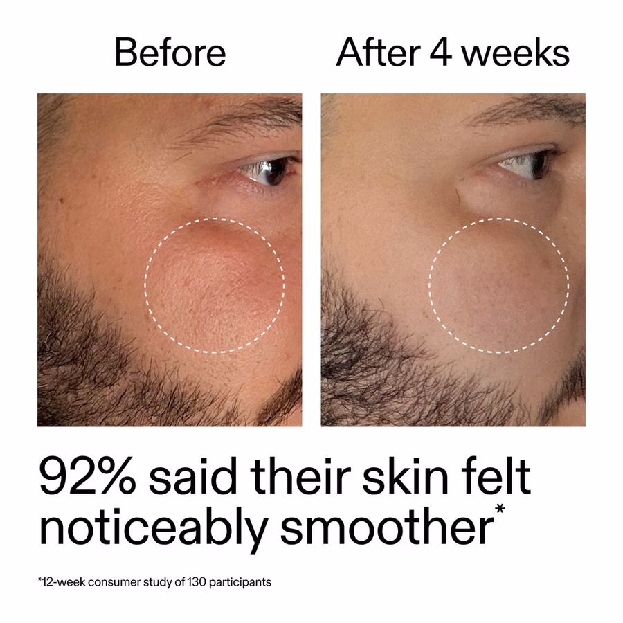 Best Beginner Retinol Serum | Smooth Fine Lines in 7 Days | The INKEY List