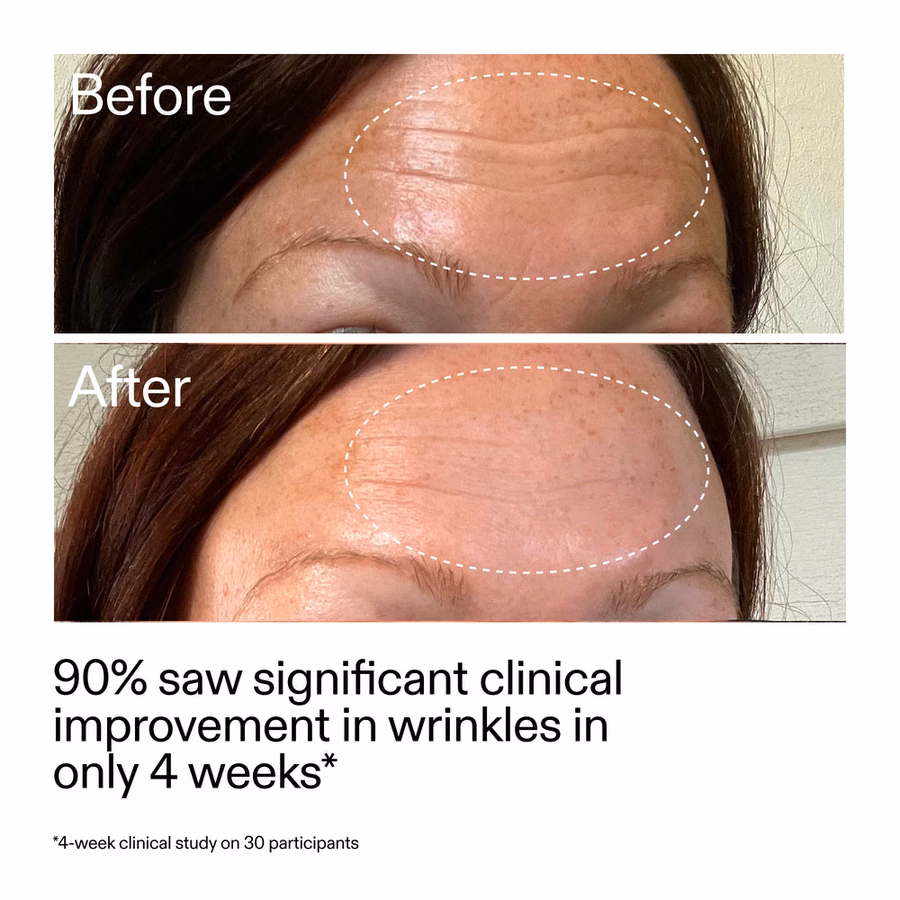Best Beginner Retinol Serum | Smooth Fine Lines in 7 Days | The INKEY List