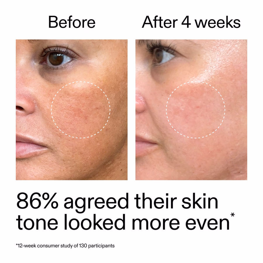 Best Beginner Retinol Serum | Smooth Fine Lines in 7 Days | The INKEY List