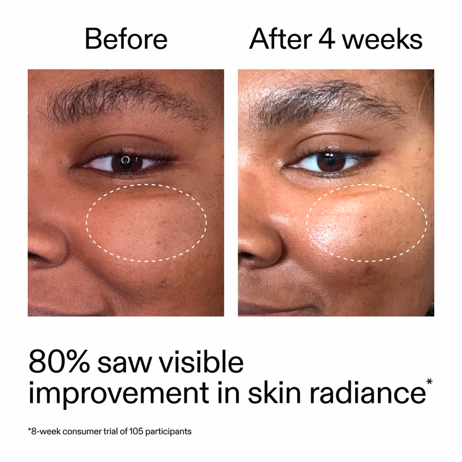 Advanced 0.2% Retinal Serum - 11x Faster Than Retinol | The INKEY List