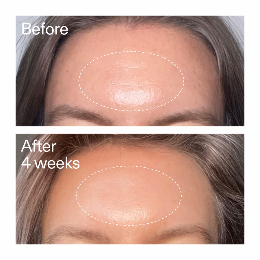 Advanced 0.2% Retinal Serum - 11x Faster Than Retinol | The INKEY List