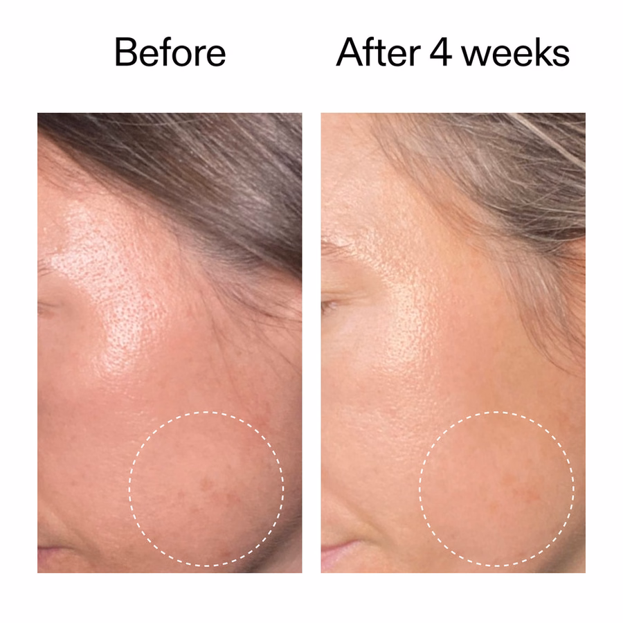 Advanced 0.2% Retinal Serum - 11x Faster Than Retinol | The INKEY List
