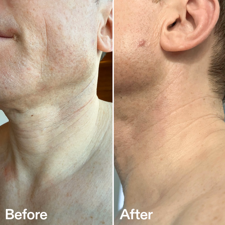Bio-Active Ceramide Neck Stick | Neck Lines | INKEY List UK