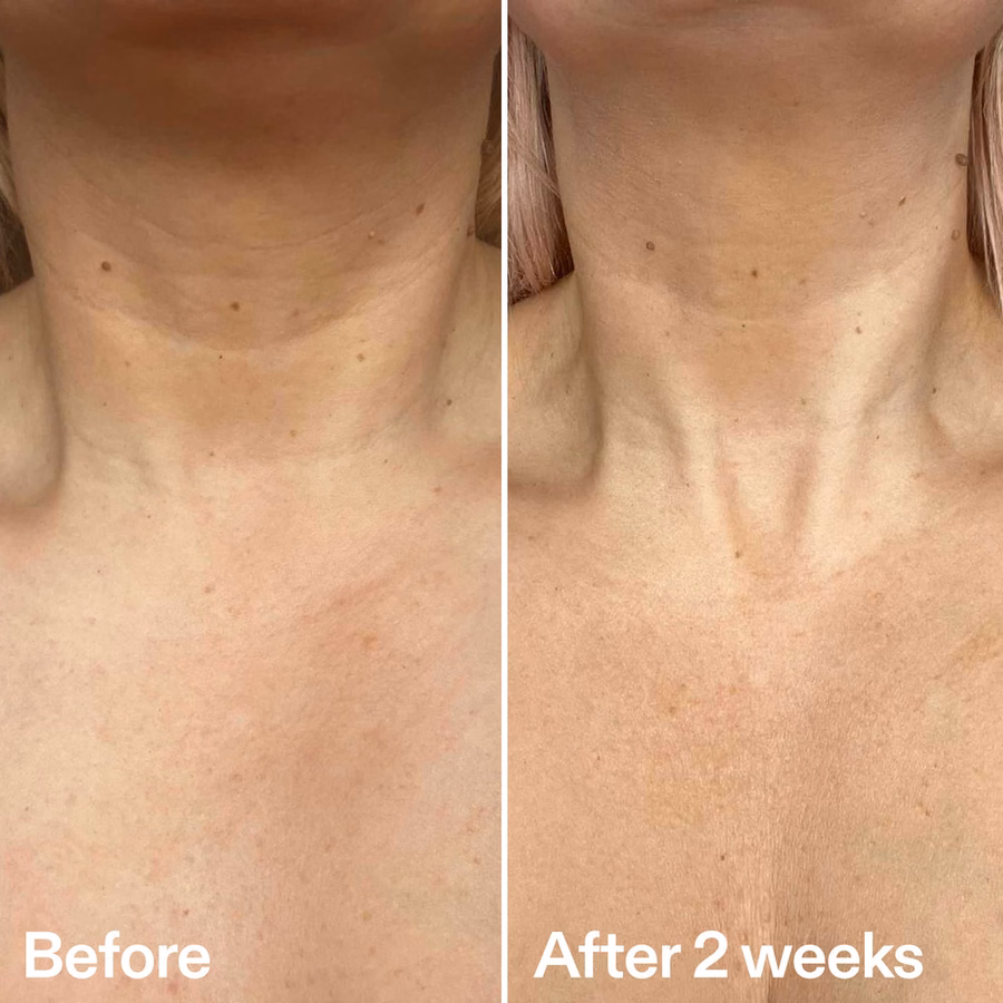 Bio-Active Ceramide Neck Stick | Neck Lines | INKEY List UK