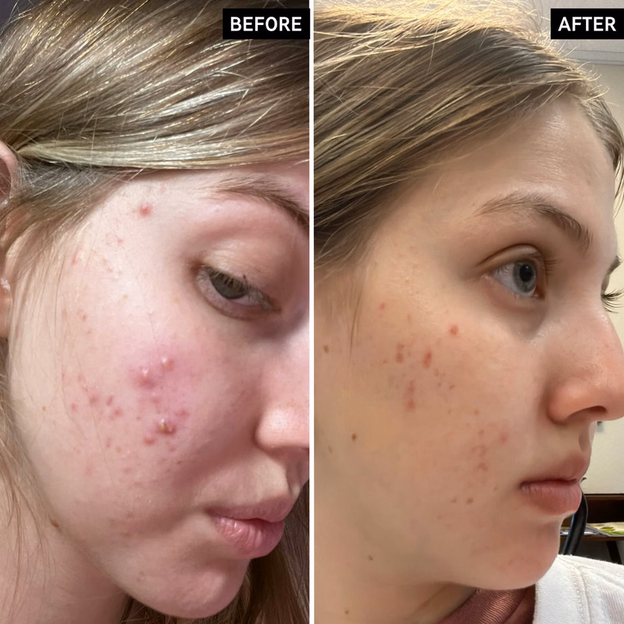 The INKEY List USA Salicylic Acid Cleanser & Face Wash Duo