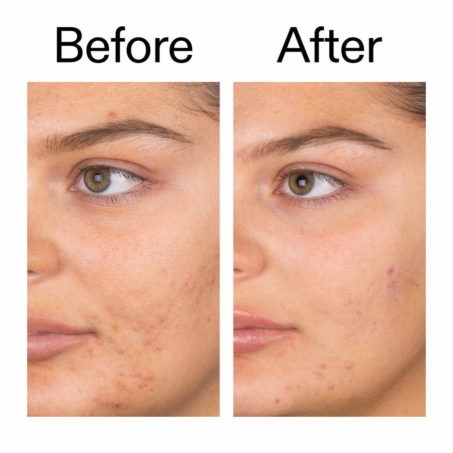 The INKEY List USA Salicylic Acid Cleanser & Face Wash Duo