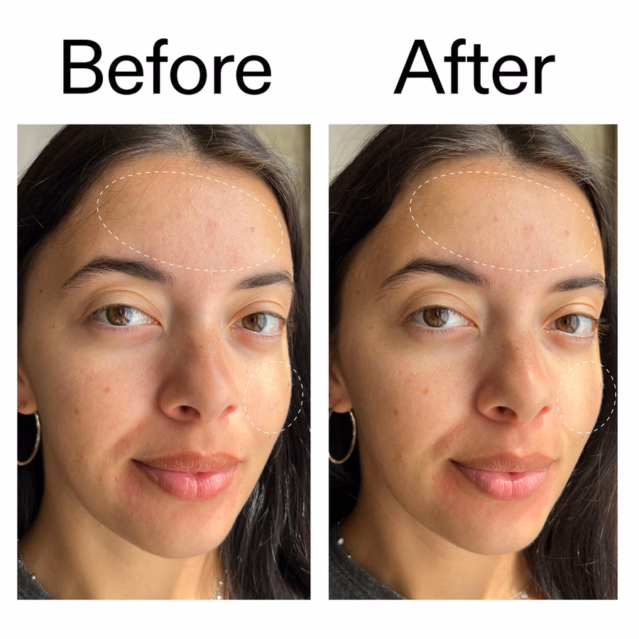 Gentle Glycerin Cleansing Gel for Face | Blemish Control Cleanser | The INKEY List USA