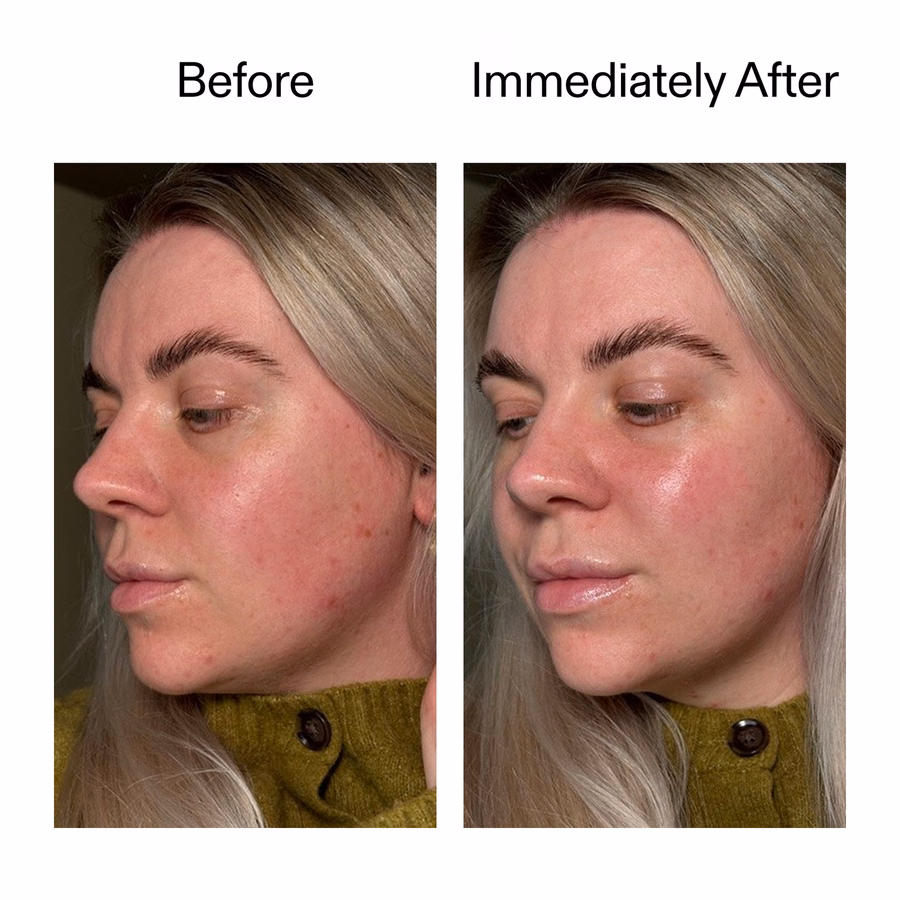 Plant-Derived Cica Exosome Serum | 6-in-1 Glow & Renewal | The INKEY List