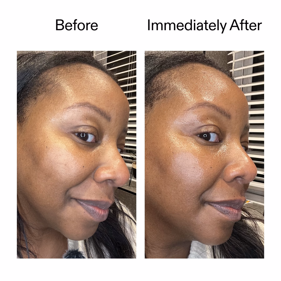Plant-Derived Cica Exosome Serum | 6-in-1 Glow & Renewal | The INKEY List