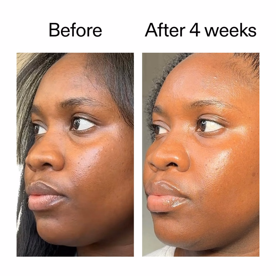 Plant-Derived Cica Exosome Serum | 6-in-1 Glow & Renewal | The INKEY List