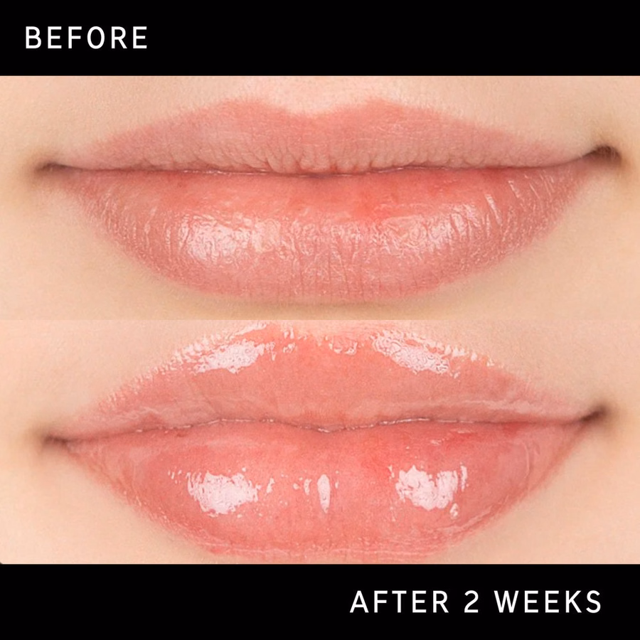 Best Volumizing Lip Plumper - Clinically Proven 40% Results | INKEY USA