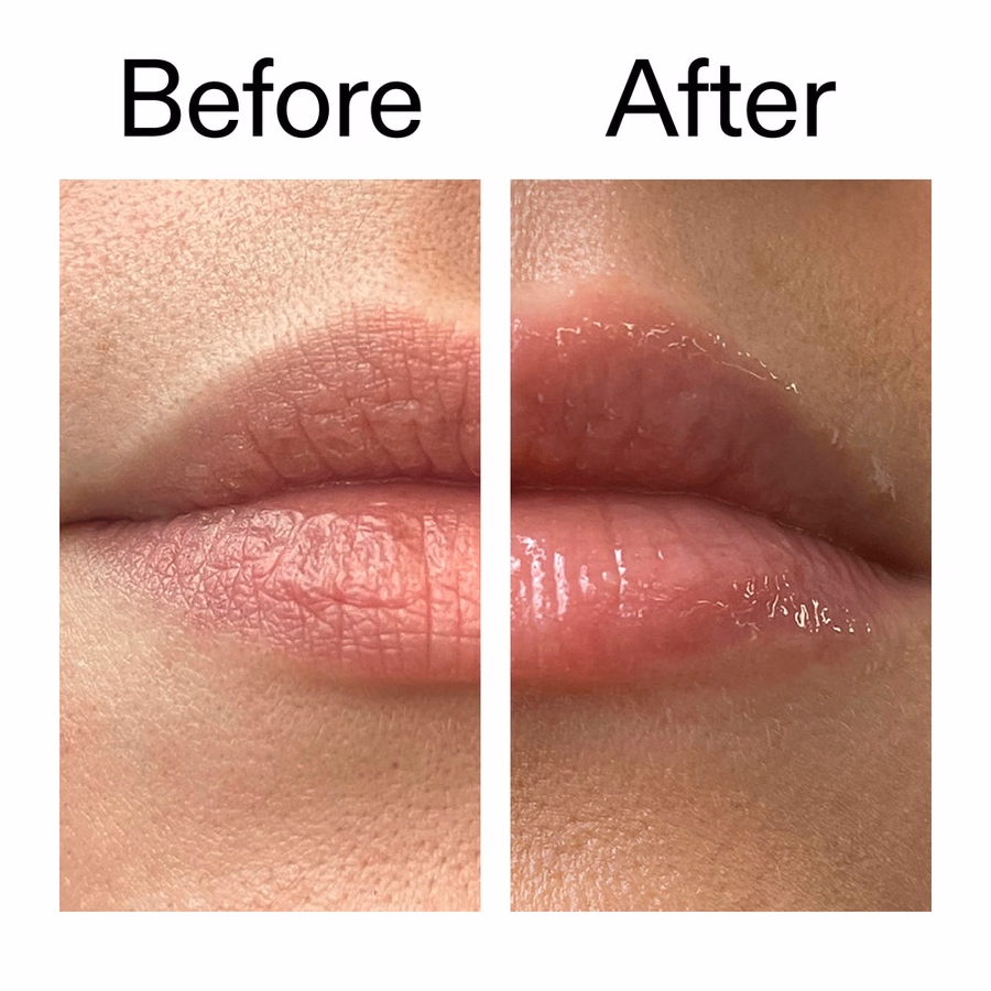 Best Volumizing Lip Plumper - Clinically Proven 40% Results | INKEY USA
