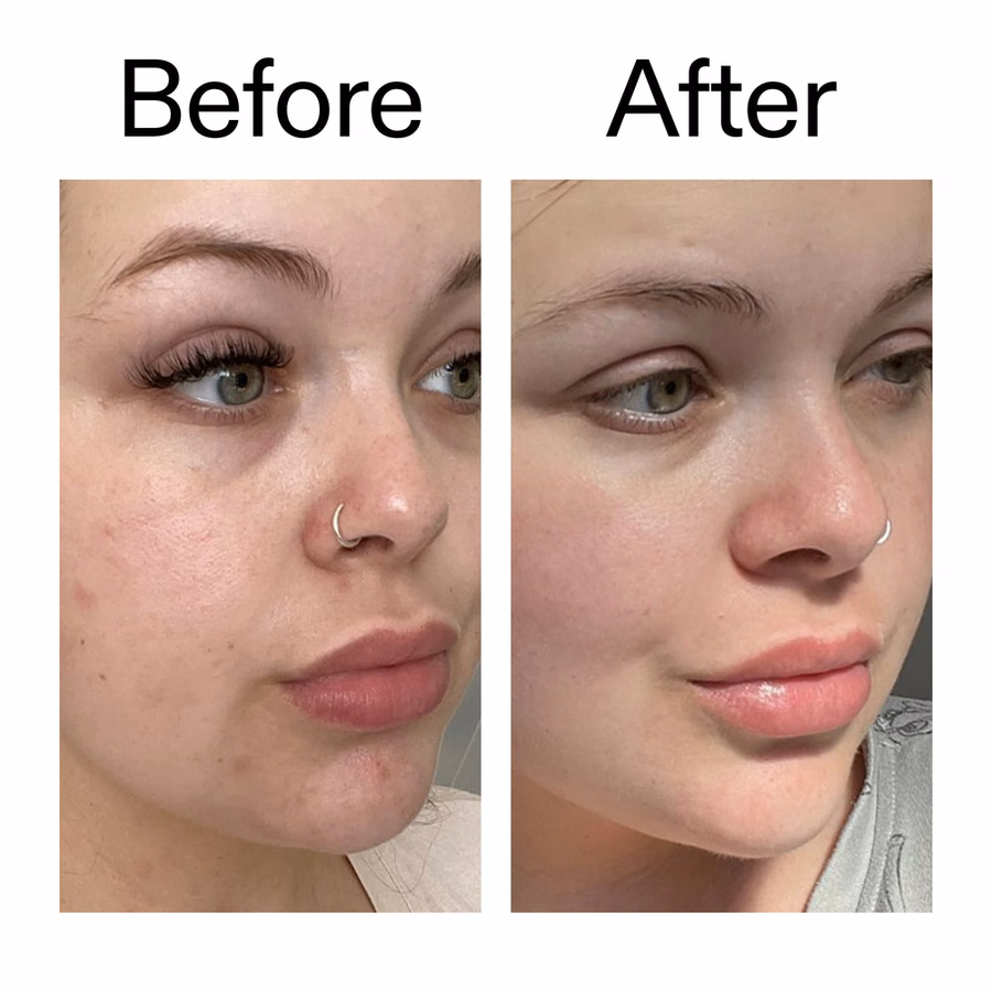 Oil Free Moisturizer for Oily Skin - Omega Water Cream | The INKEY List USA