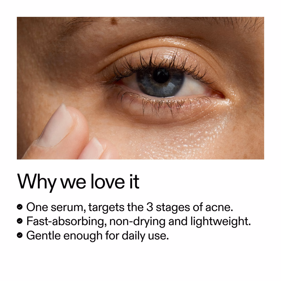 Salicylic Acid Acne Serum with Dioic Acid | 360° Skin Clearing | INKEY USA